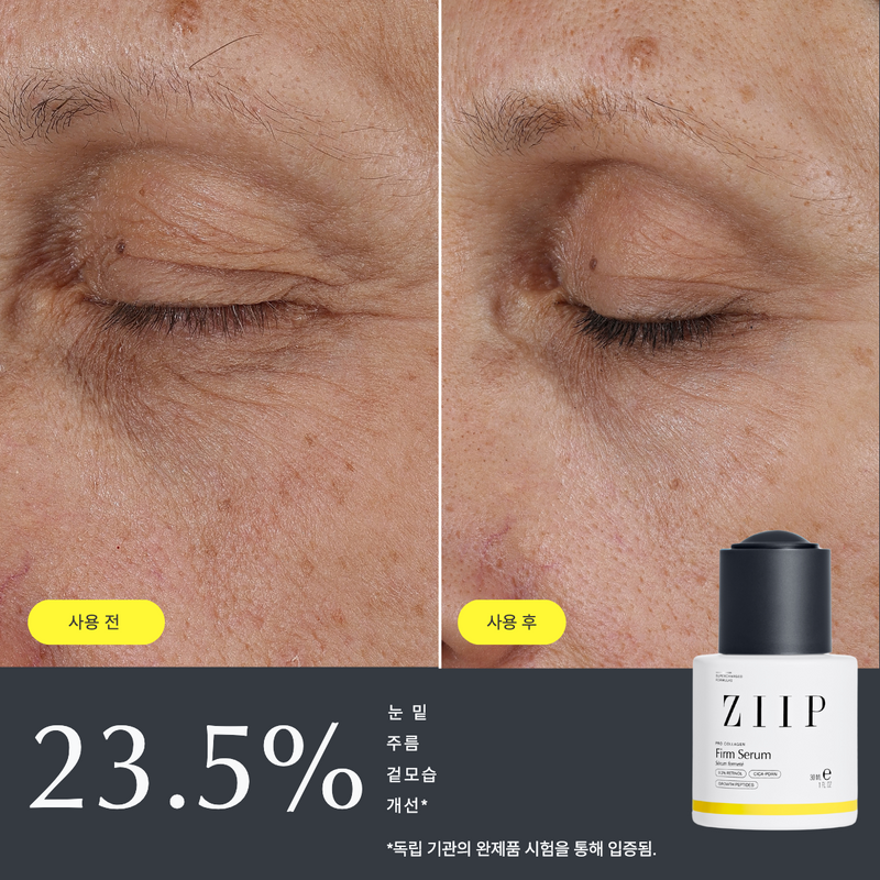 ZIIP 탄력 레티놀 세럼
