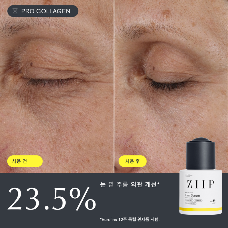 ZIIP 탄력 레티놀 세럼