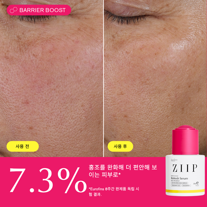 ZIIP 리프레시 트라넥삼산 세럼